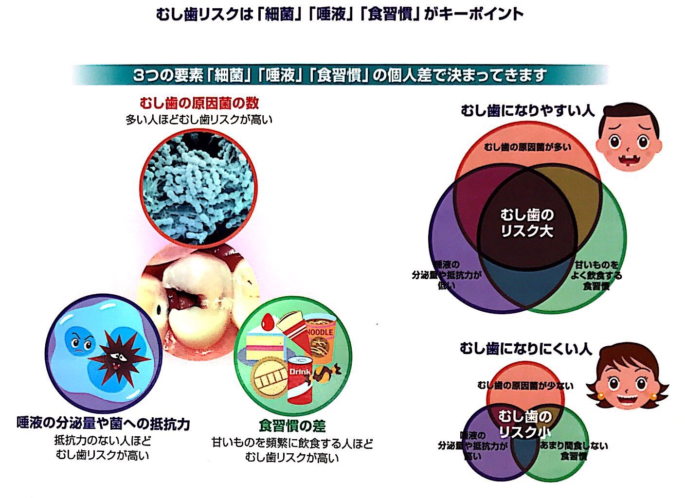 虫歯になる要因