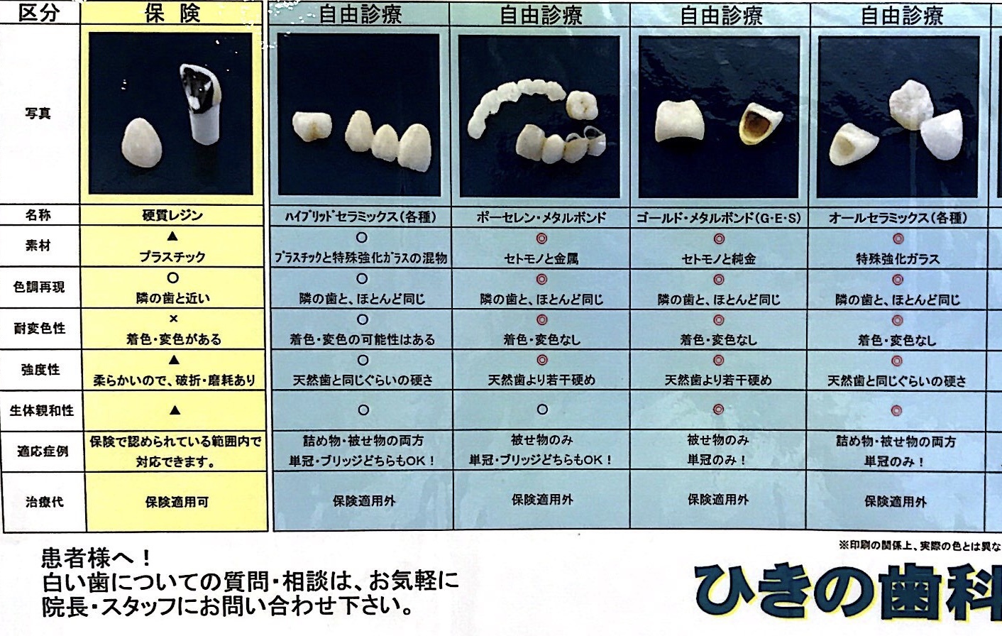 様々な素材の被せ物の利点、欠点